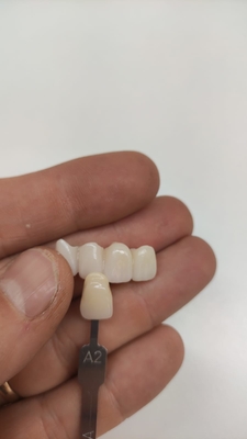 High-Performance Multi-Layered Zirconium Ceramics for Roland VHF Imes-icore